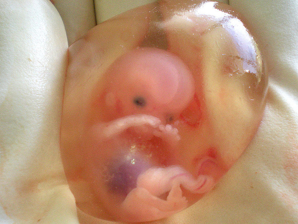 21 semanas
