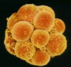 aborto3tage_t